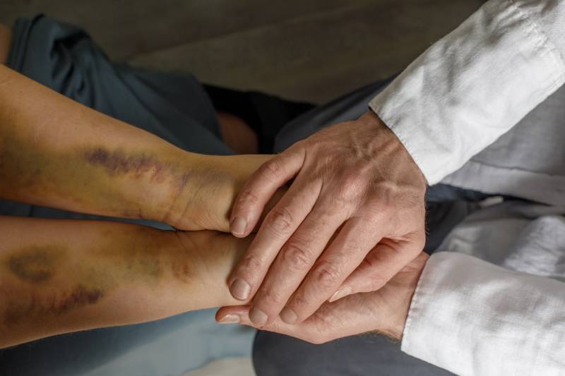 Témoin de violences conjugales, que faire pour aider la victime?